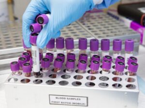 blood-testing-samples