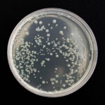 petri dish