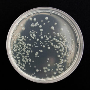 petri dish